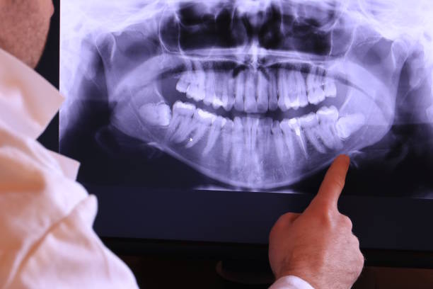 Best Tooth Infection Emergency Dentist  in Eslon, CA