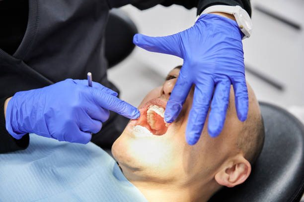 Best Emergency Tooth Extraction  in Eslon, CA